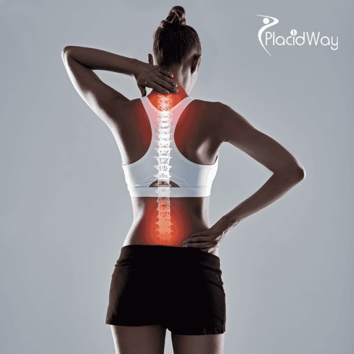 Laminectomy for Spinal Stenosis in Turkey: A Guide for UK Medical Travellers